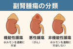 副腎腫瘍を視覚的に説明する図解｜機能性・非機能性・悪性の3分類をわかりやすく表示｜しもやま内科（船橋市）