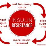 インスリン抵抗性