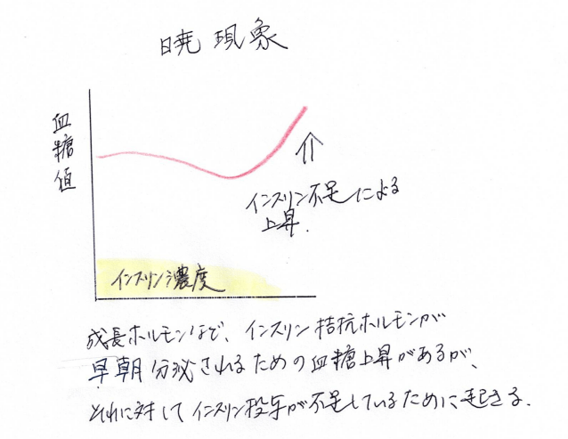 暁現象,船橋市の糖尿病内科,しもやま内科