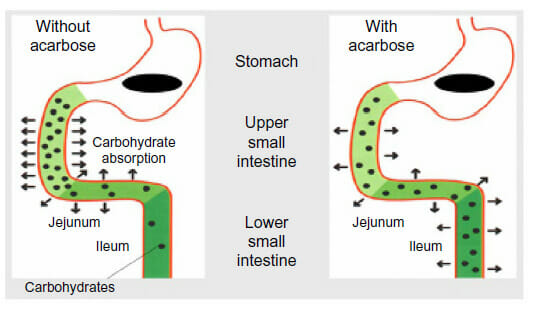 α-グルコシダーゼ阻害薬の作用