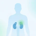 褐色細胞腫（副腎にできるホルモン産生腫瘍）を模式的に示した医療イラスト｜しもやま内科