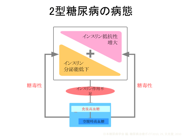 2型糖尿病の病態