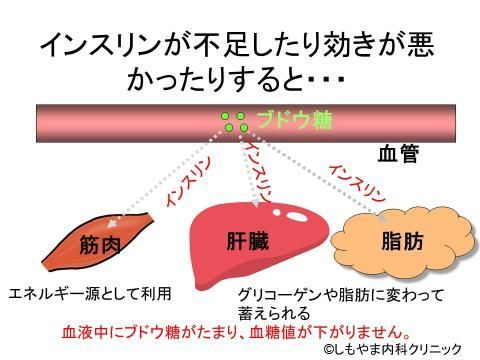インスリン作用不足