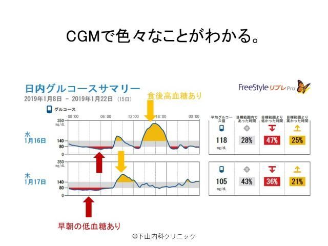 CGMでわかること