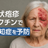 帯状疱疹と認知症の関連を解説する高齢女性のイラスト｜しもやま内科（船橋市）