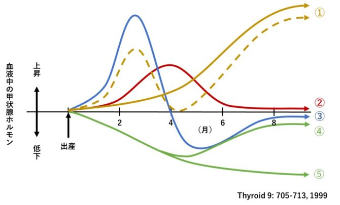 産後の甲状腺障害