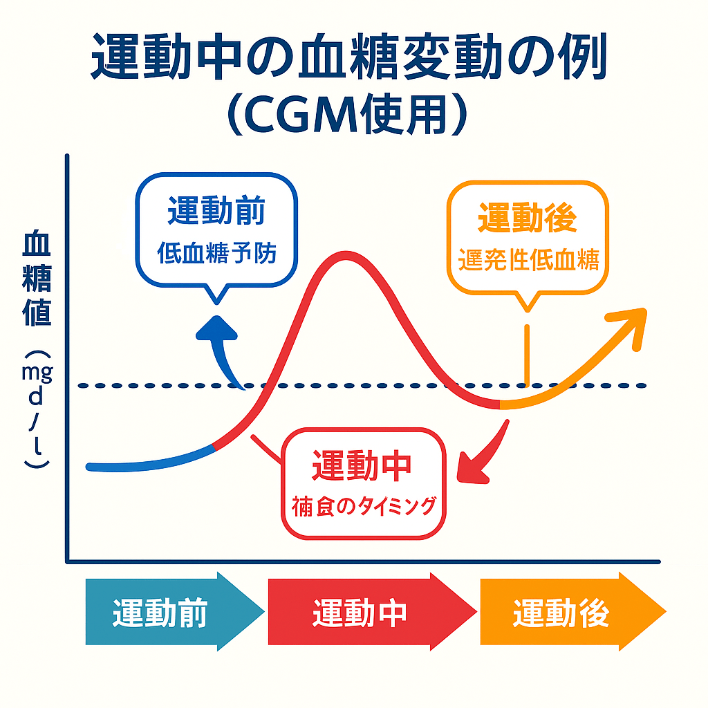 CGMと運動