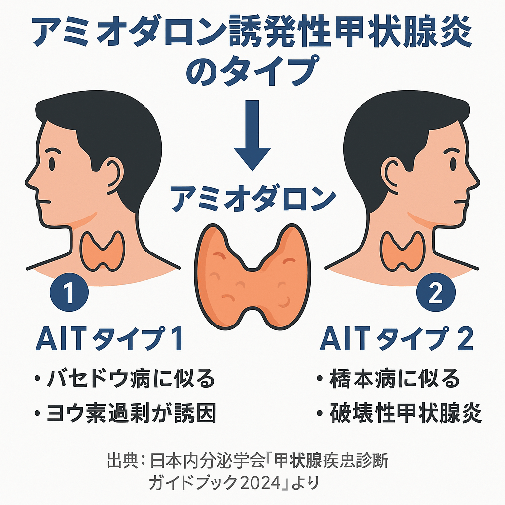 アミオダロン誘発性甲状腺炎のタイプ別分類