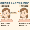 顔面神経痛と三叉神経痛の違いを解説するイラスト。顔面神経痛は顔の広い範囲に持続的な痛み、三叉神経痛は顔の一部に発作的な痛みが出る。